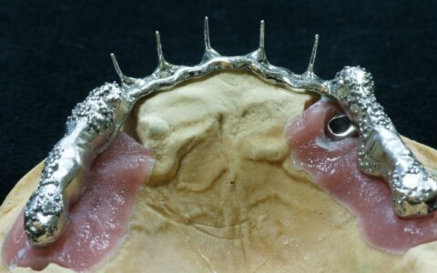 struktura wtórna z retencjami dla zębów sztuczych